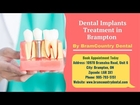 Dental Implant Procedure by BramCountry Dental | Best Dentist in Brampton