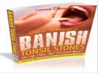 Tonsil Stones Secret Home Remedies Review - 100% Real & Honest